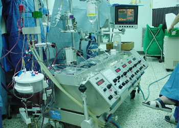 인공심폐기 에크모(ECMO) 사진