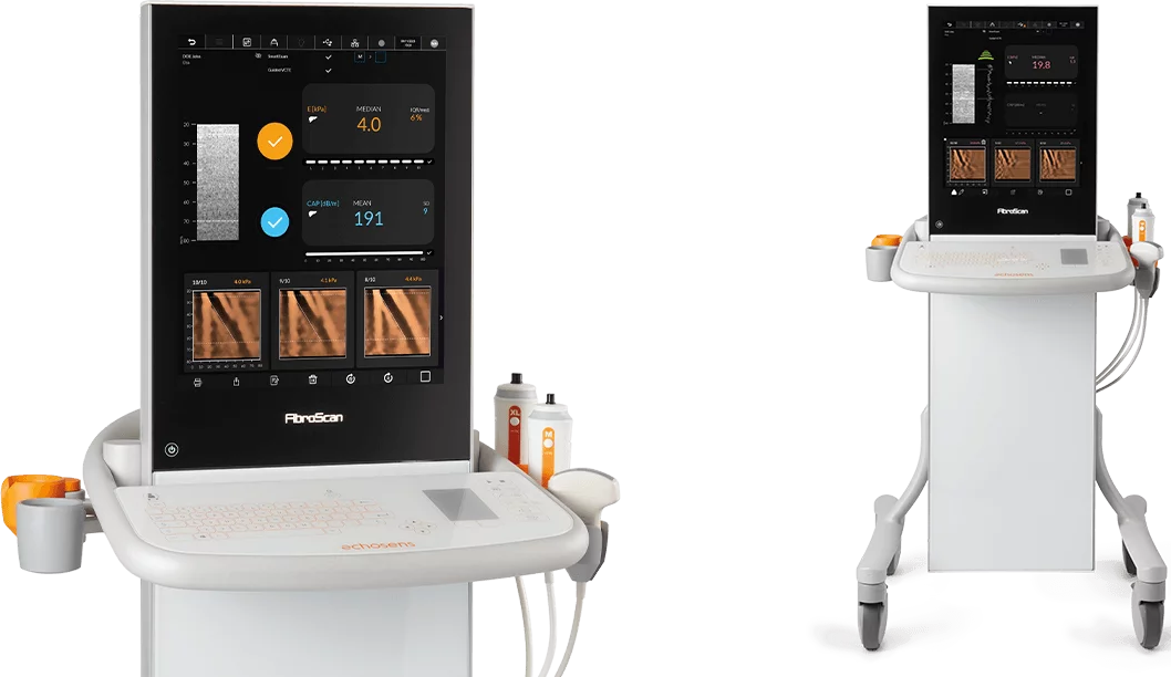 Fibroscan