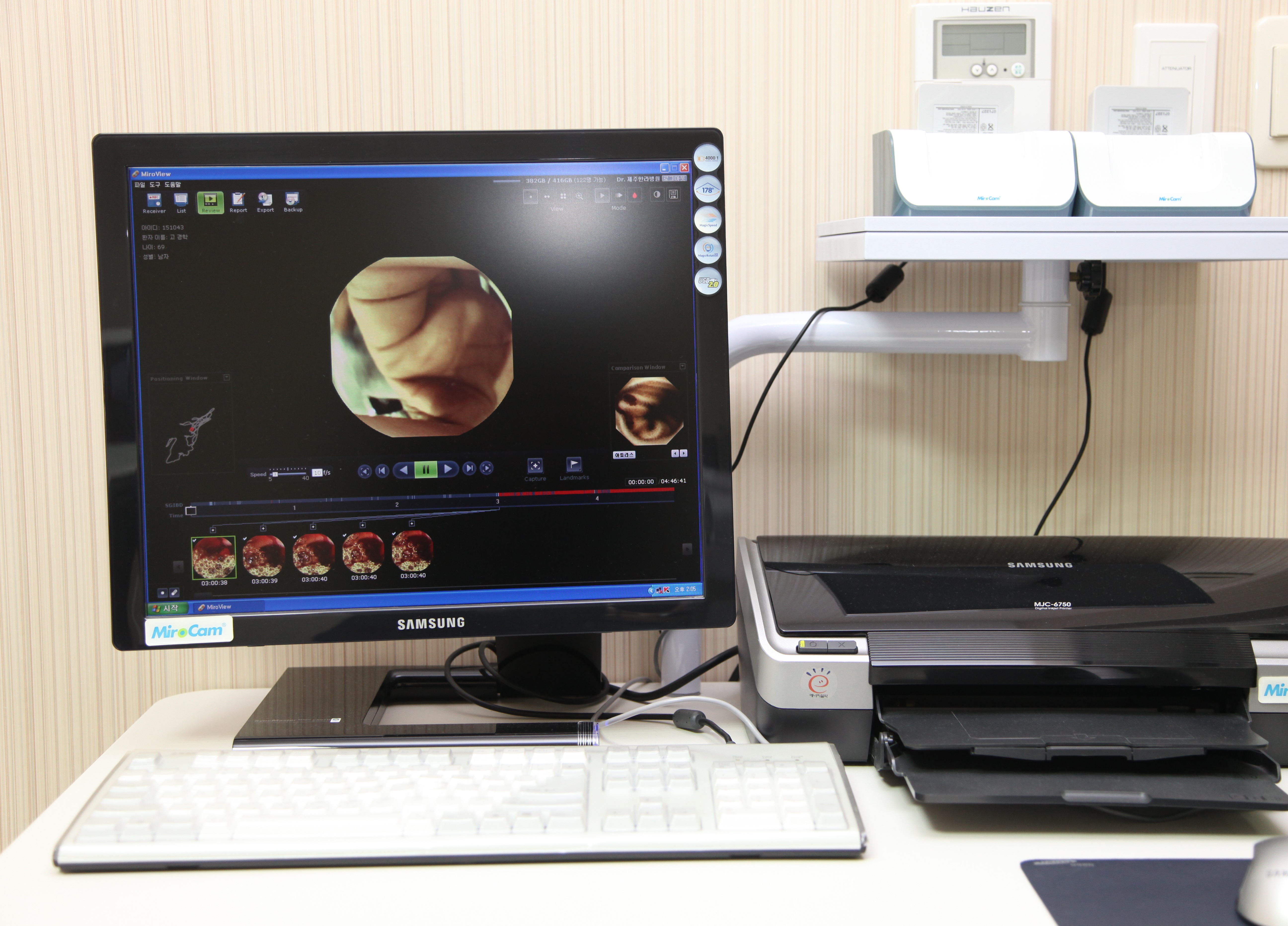 캡슐내시경 장비