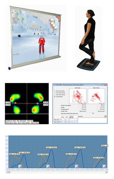 균형능력 측정(훈련)시스템를 사용하는 사진과 데이터 그래프