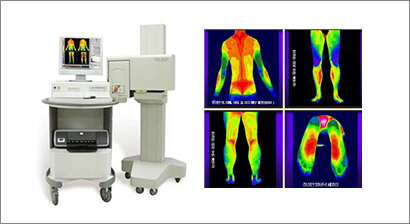 적외선 체열 진단 검사기 사진과 결과 사진