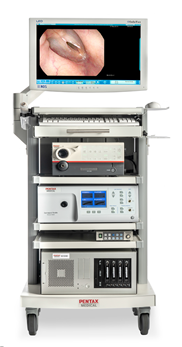 후두전자내시경 및 후두스트로보스코피 사진